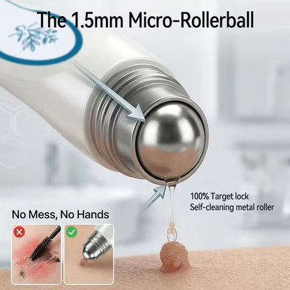 YAGOO® 7-Day Skin Tag & Spot Eraser Painless & Scar-Free Advanced Imperfection Removal Rollerball Pen