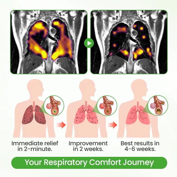 ❣️✅UK Owned and Operated|Botanical Mullein Lung Cleanse Diffuser (💝 Cough, wheezing, shortness of breath, sputum, stuffy nose, bronchitis, bronchitis, allergy symptoms, lung discomfort💝)