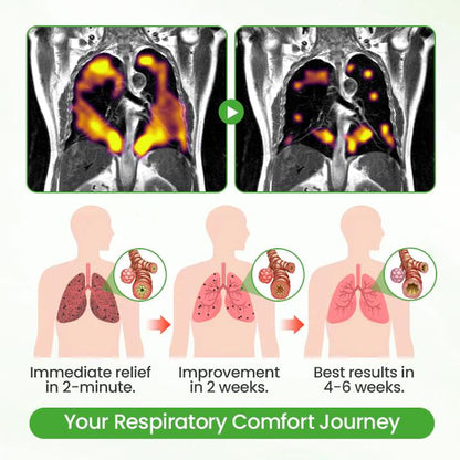 ❣️✅UK Owned and Operated|Botanical Mullein Lung Cleanse Diffuser (💝 Cough, wheezing, shortness of breath, sputum, stuffy nose, bronchitis, bronchitis, allergy symptoms, lung discomfort💝)
